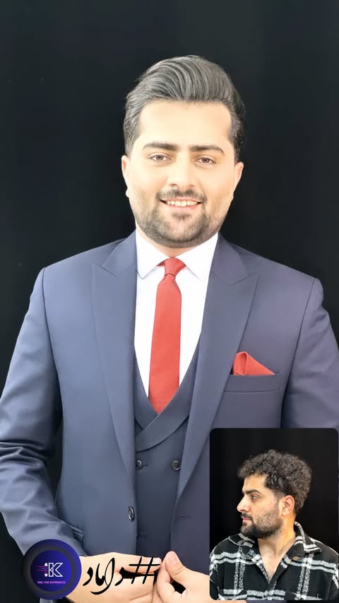 قبل و بعد داماد