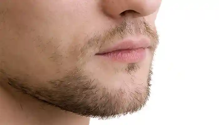 ریش سه روزه